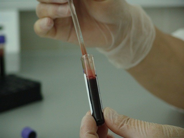 Blood test image determining how long Delta 8 THC stays in your system