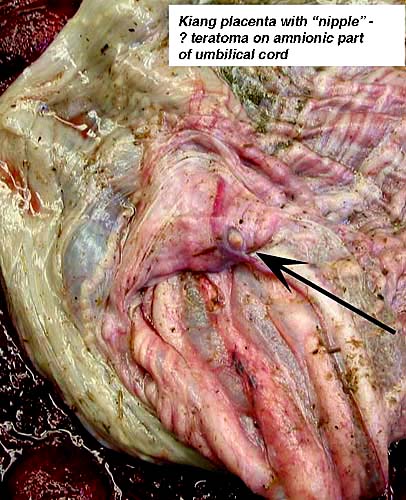 The arrow points to a small nipple-like structure at the junction of amnionic and allantoic portion of the umbilical cord
