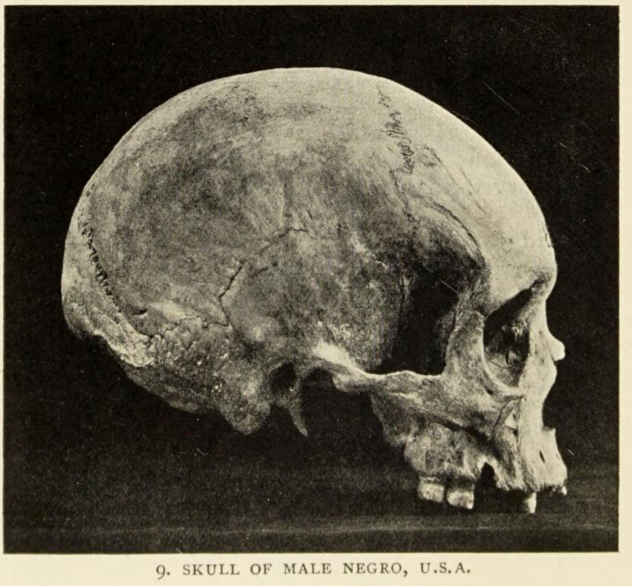 Black and white photograph of a side view of a partial human skull (lower jaw missing); from "The Negro in the New World," Harry H Johnston, 1910