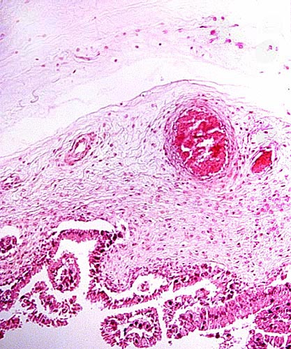 Surface of placenta with pigmented trophoblast beneath chorion