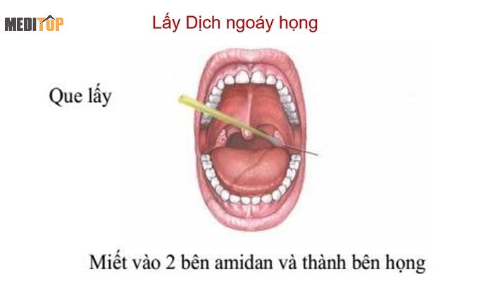 Ống vận chuyển môi trường