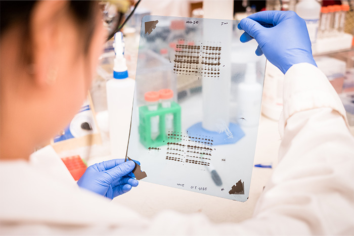 protein detection & analysis