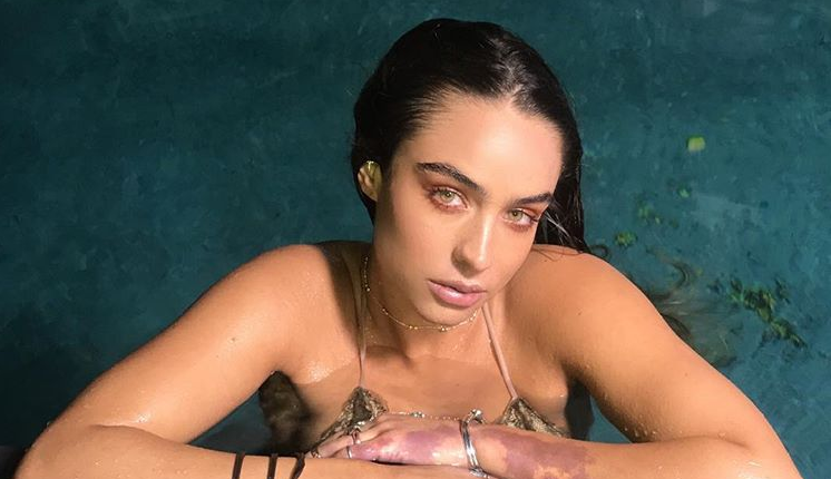 Sommer Ray Rumors and Controversies