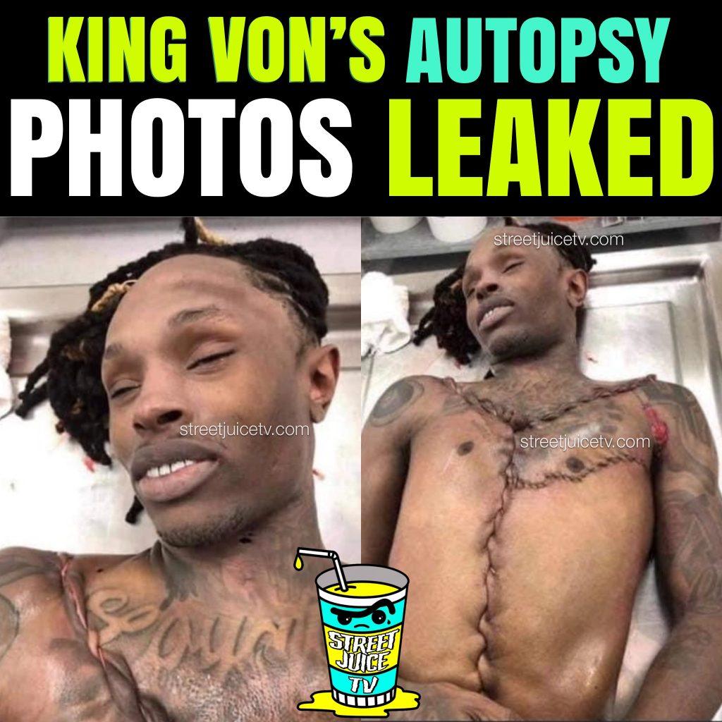 King Von's Autopsy Photos Leaked! (Sensitive Content) - Street Juice TV