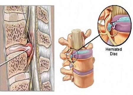 vật lý trị liệu