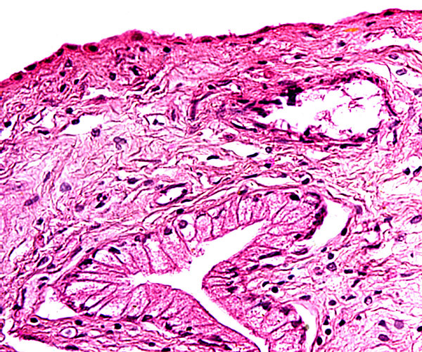 The trophoblast beneath the chorionic plate is mostly cylindrical