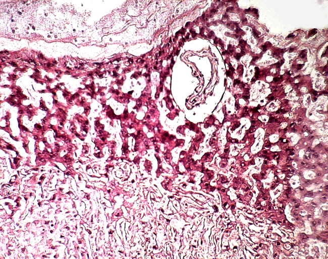 Higher magnification of border between trophoblastic giant cells (above) and trophospongium (below).