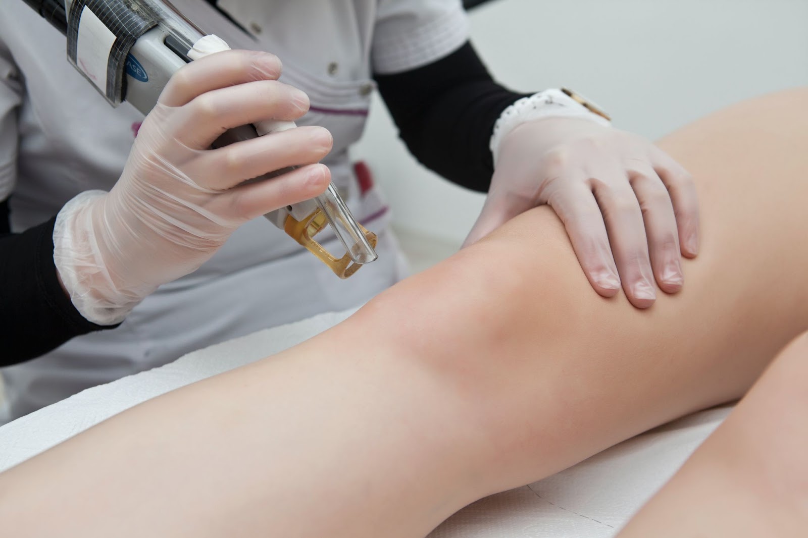 Laser Hair Removal FAQs: What You Should Know - Healthcare Business Today