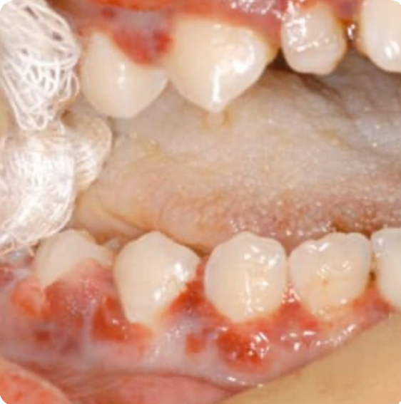A Guide to Clinical Differential Diagnosis of Oral Mucosal Lesions by DentalCare.com