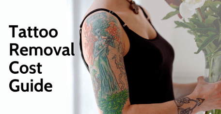 Tattoo Removal  Costs Risks and Considerations  Costhetics