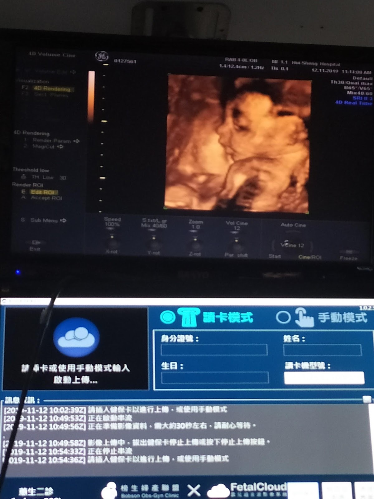 懷孕剛滿28週，寶寶大腿骨比較短，孕期總是擔心不完的媽咪_img_51