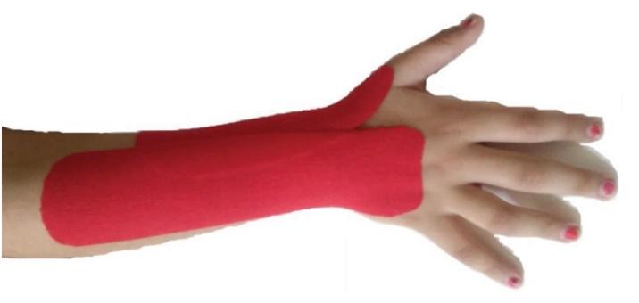 kinesio tape for finger extension