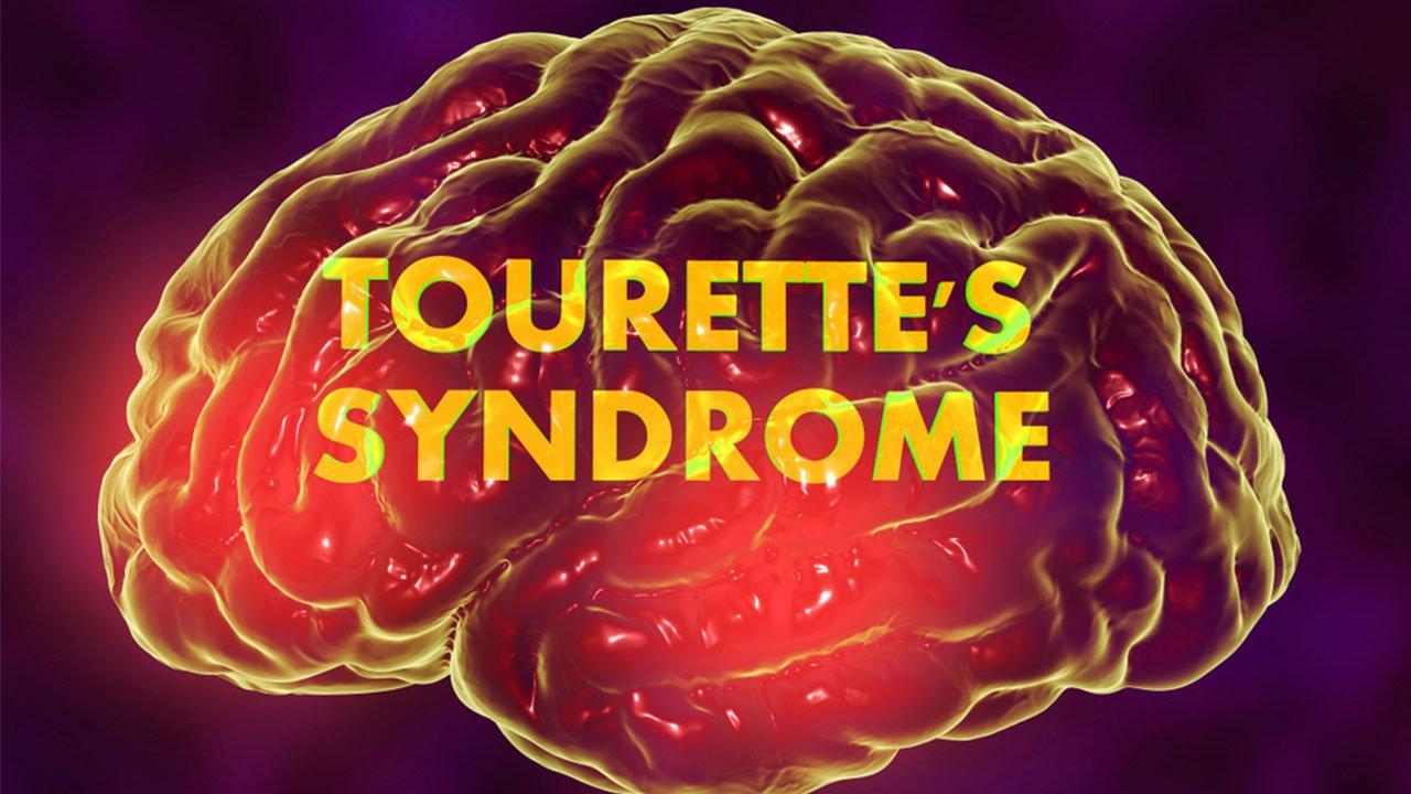 Tourette Syndrome: Dispelling the Myths – The Amino Company