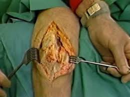 Image result for orthopedic surgeon