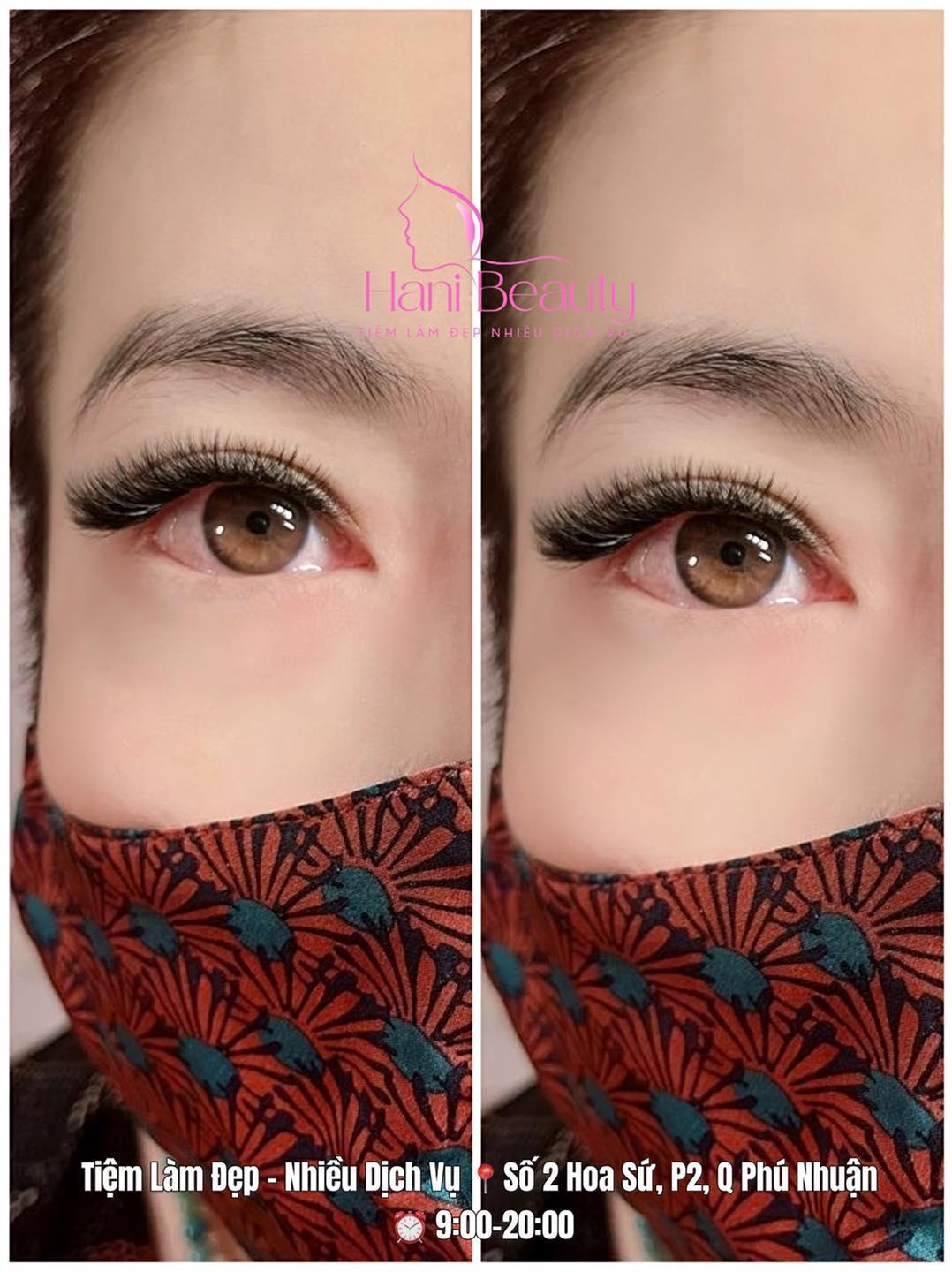 https://lh5.googleusercontent.com/f4XalTAbUtoB9yhrcXhvi9g25dLPTbGVfCC9RpGTIEP2K0RA_WRgLLmA-b-OWTGJoRAp3iim5bHR77gKrdrNcCASIVL1WZ33Zp-cAFn74PxvB9RXFlJzvY89vsjcZ6i4DRMhoQugpwOuojANfsFojQ