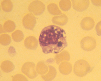 Morula de Ehrlichia en células mononucleares circulantes en un perro infectado (Giemsa).