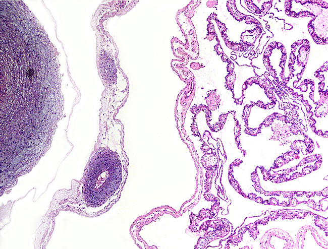 Fetal cord vessel at left. Next to it is the amnion and allantoic membrane with allantoic vessels. Membrane at right is the yolk sac remains