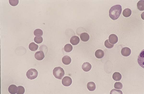 Canine blood, RBC ghosts. Several RBCs are noted that have almost...