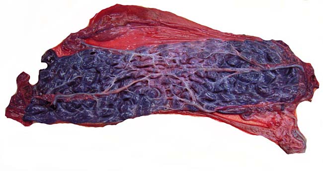 this appearance of a multicotyledonary placenta