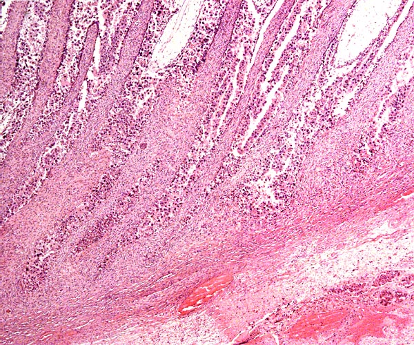 Implantation of immature cotyledon on uterus below