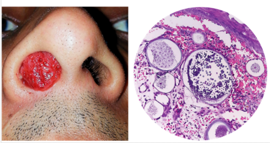 Nose and Paranasal Sinuses