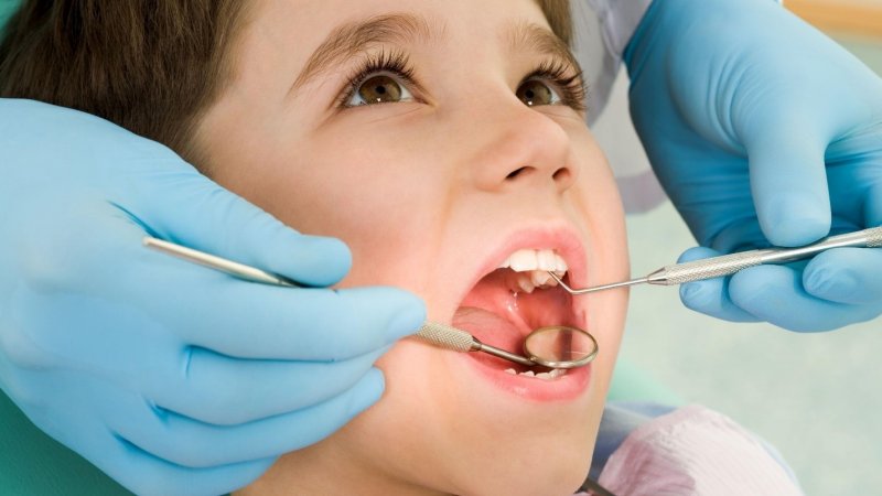 Bác sĩ kiểm tra tình trạng răng miệng trước khi trám