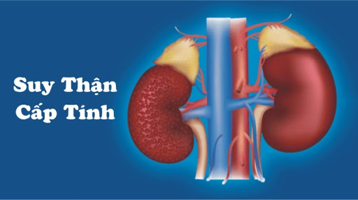 Suy thận cấp tính do tiêu cơ vân cấp