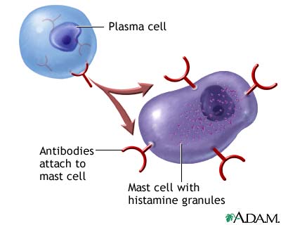 NCLEX Review on Oncology, STD and Immune System | NCLEX ... lupus diagram 