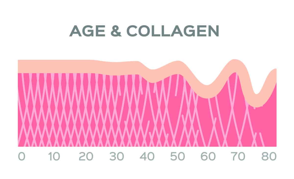 under eye bags collagen