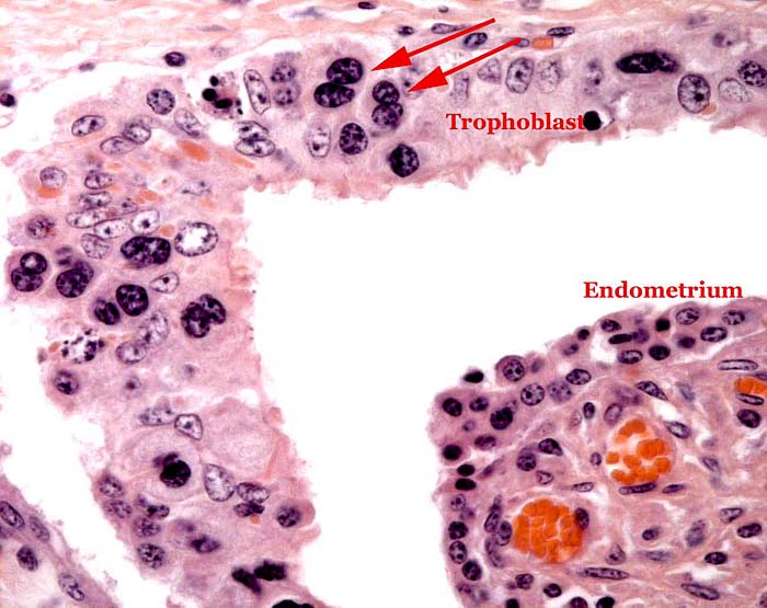 Trophoblast with binucleate cells on the fetal surface