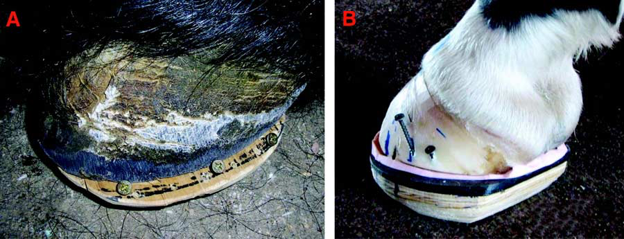 A) Wooden shoe fitted with an extension on the lateral side.
(B) Wooden shoe with extension being attached to foot with screws. 
