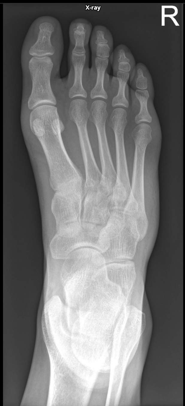 radiografia de pé