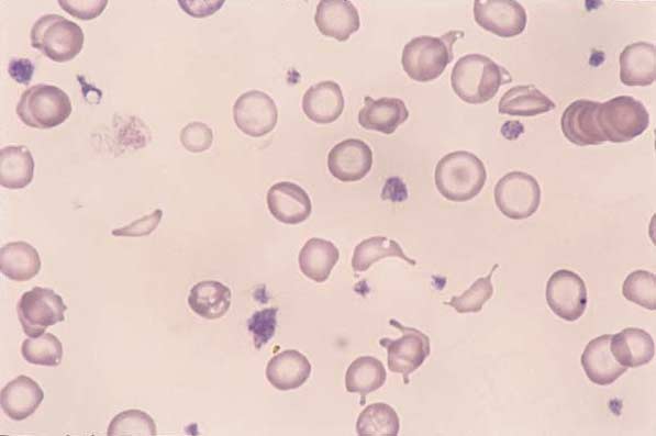 Canine blood. Numerous poikilocytes, marked hypochromia...