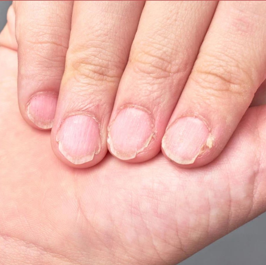 Home DIY Treatment For Brittle Nails – Double Dip Nails