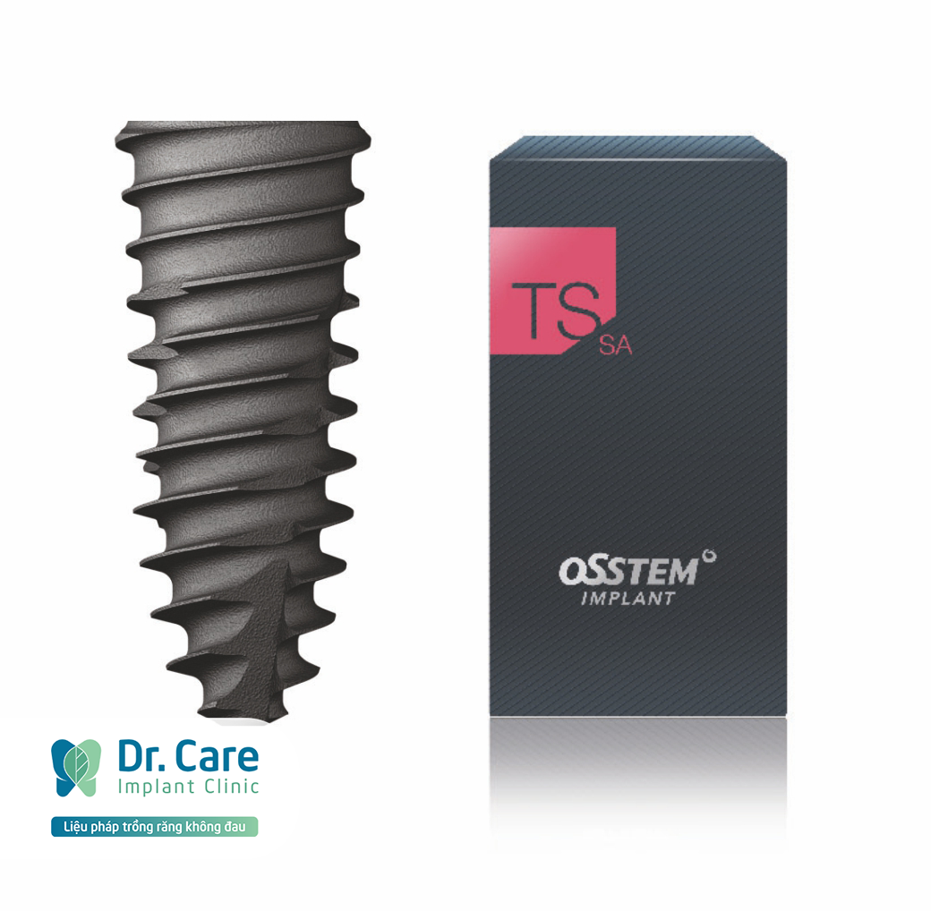  Osstem Implant: Xuất xứ, ưu điểm, giá cả