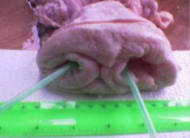 The reproductive tract of a buffalo heifer showing two cervical canals (Photo Courtesy Prof. Azawi O.I., Department of Surgery and Theriogenology, College of Veterinary Medicine, University of Mosul, Mosul, Iraq).