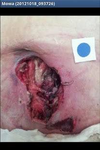 Download MOWA – Wound Care Solution apk