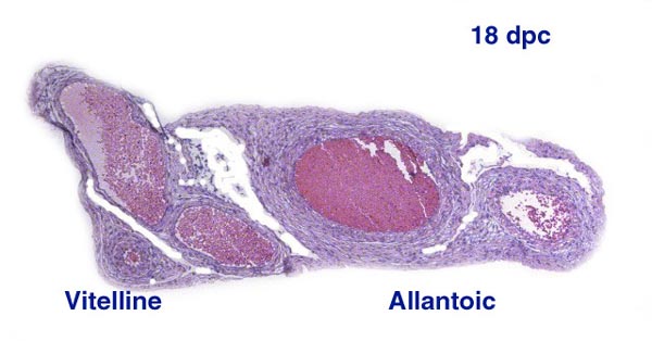 Cross section of umbilical cord near the abdomen