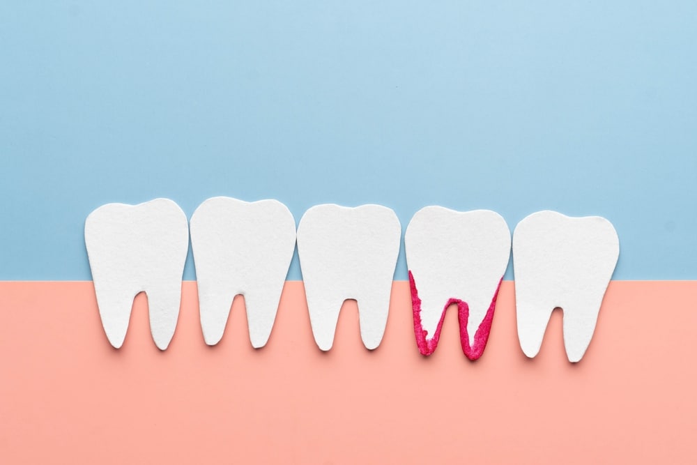 Dental Facts | 12 Oaks Dental