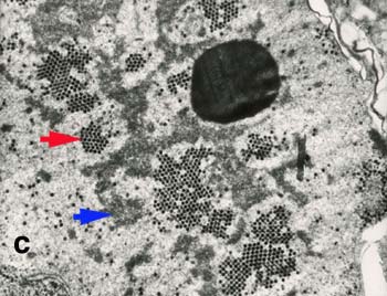 Higher power imaged of an EAdV1 infected cell showing mature virions in a paracrystalline array (red arrow) and viral precursor material (blue arrow).