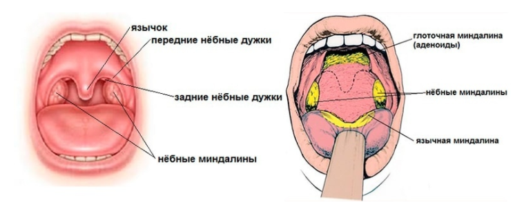 Увеличенные миндалины без температуры