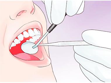 снятие швов после удаление зуба киев