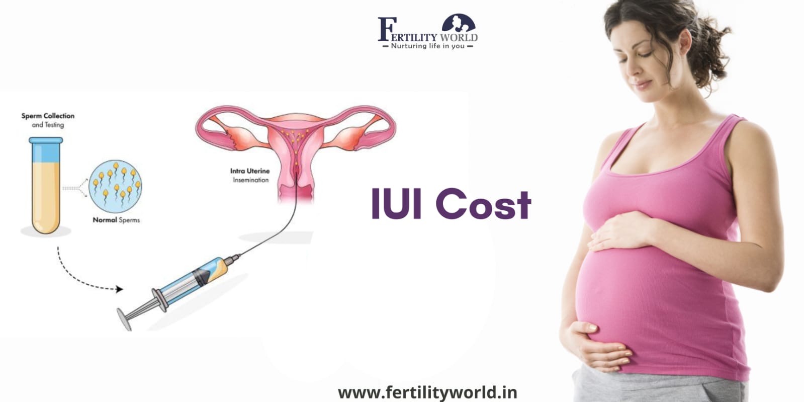 Intrauterine Insemination (IUI) cost in Jodhpur 