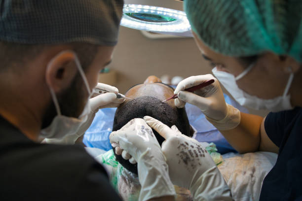 Hair Transplant Treatment in Delhi