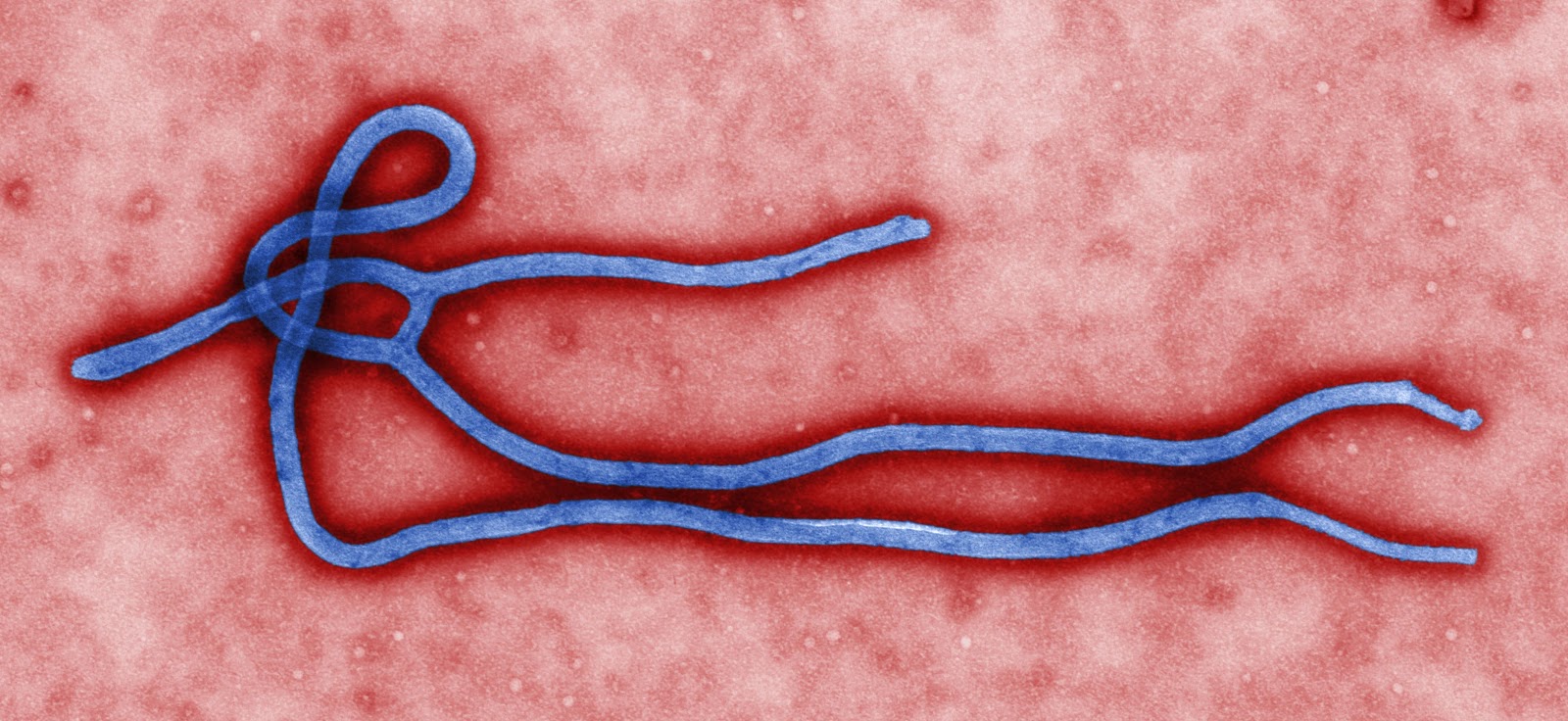 File:Ebola virus virion.jpg