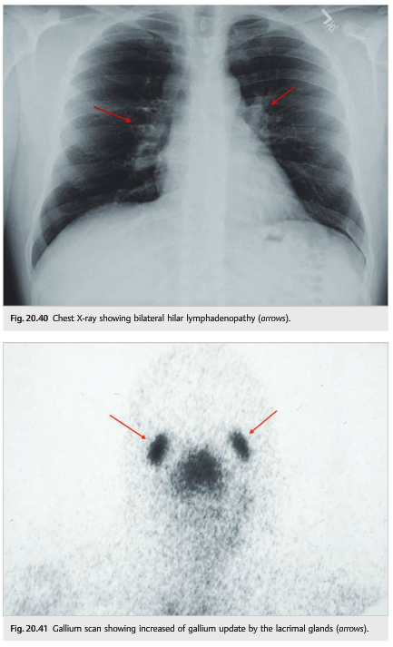 questions test pressure intracranial the week: questions Neuro of ophthalmology NOI20