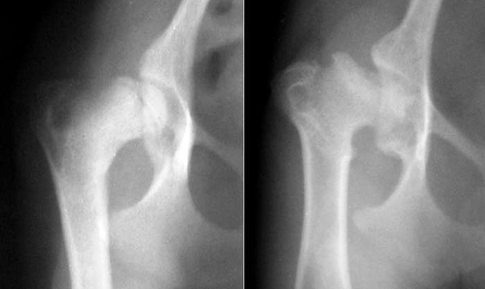 Hip-extended radiographs of a Cairn terrier with evidence of sclerosis in the femoral neck and collapse of the femoral head