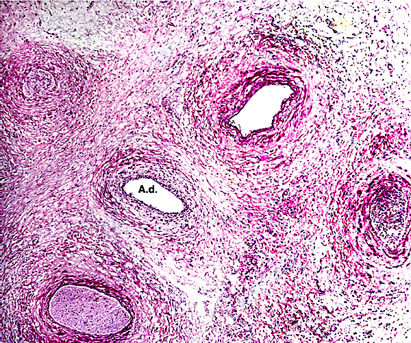 Higher magnification of cross section of the umbilical cord with allantoic duct (A.d.) in the center. No capillaries.