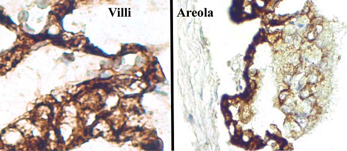 Pancytokeratin staining of the villous trophoblast (left) and the cristae of areola (right). Note the darkly-stained capsular epithelium.