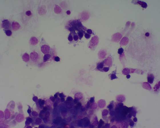Clumps of ciliated columnar epithelial cells in a TA from a horse without signs of respiratory disease. Note variable degree of preservation of epithelial cells.